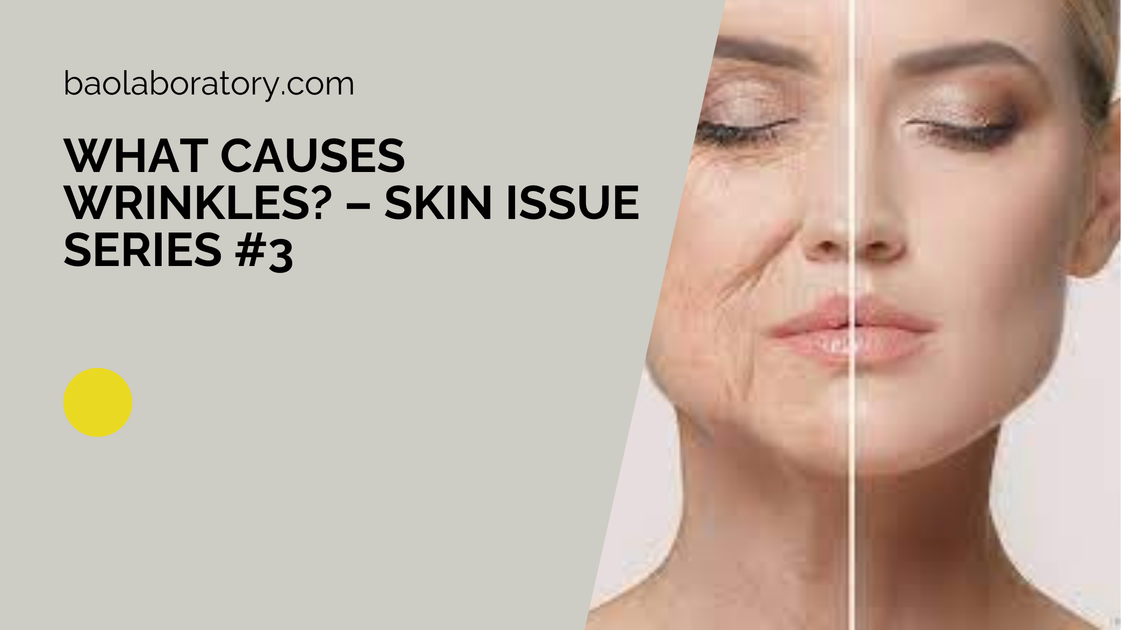 What Causes Wrinkles