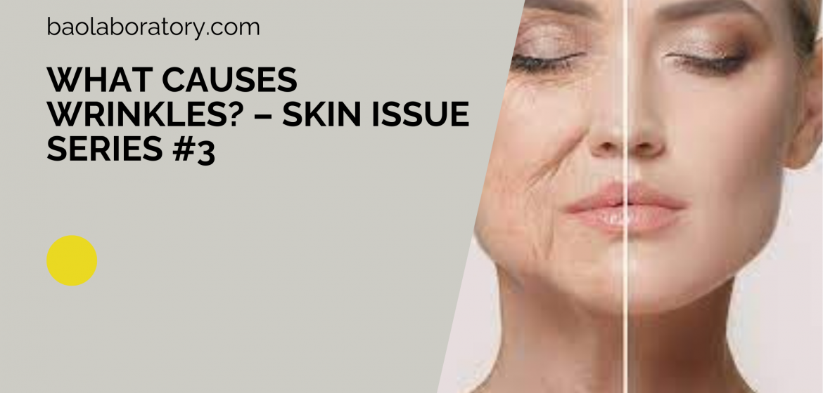 What Causes Wrinkles